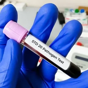 STD 20 Pathogen Test